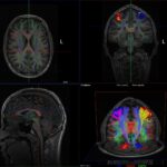 FMRI SPECTRUM