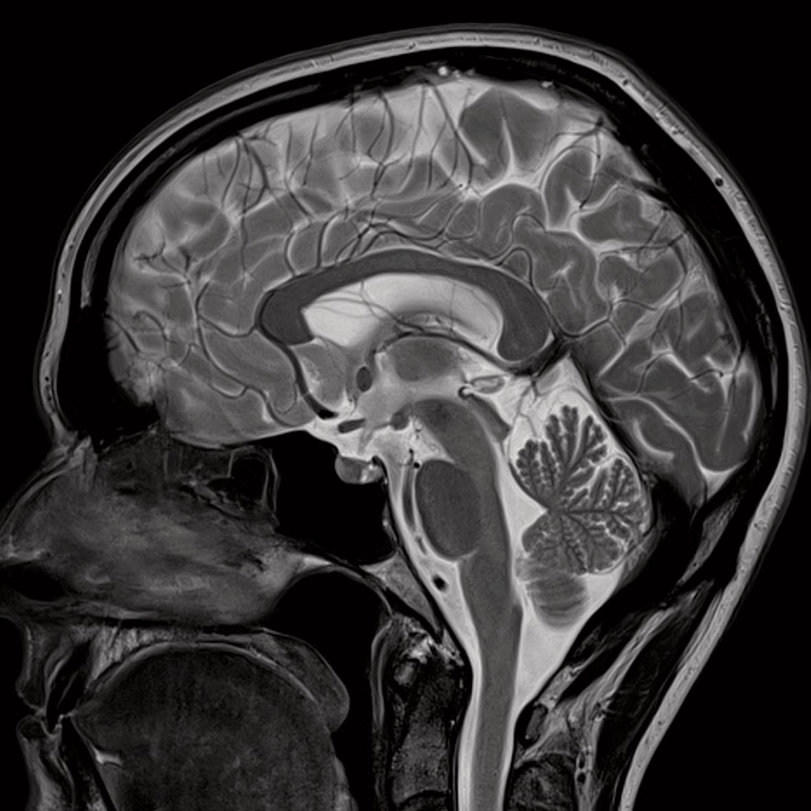 Functional MRI’s