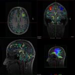 SPECTRUM MRI FMRI