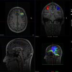 Spectrum MRI Imaging